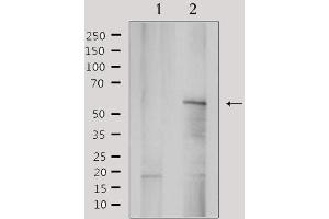 Western blot analysis of extracts from rat brain, using YTHDF1 Antibody. (YTHDF1 Antikörper  (N-Term))