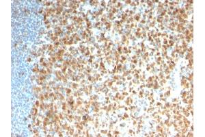 Formalin-fixed, paraffin-embedded human Tonsil stained with MCM7 Recombinant Mouse Monoclonal Antibody (rMCM7/1468). (Rekombinanter MCM7 Antikörper  (AA 195-319))