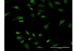 Immunofluorescence of monoclonal antibody to PRKRIP1 on HeLa cell. (PRKRIP1 Antikörper  (AA 1-184))