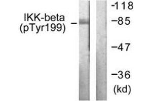 Western blot analysis of extracts from HeLa cells treated with TNF-a 20ng/ml+Calyculin A 50nM 5', using IKK-beta (Phospho-Tyr199) Antibody. (IKBKB Antikörper  (pTyr199))