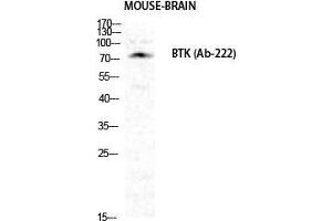 Western Blot (WB) analysis of specific cells using Btk Polyclonal Antibody. (BTK Antikörper  (Ser189))