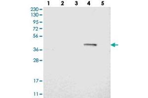 Western blot analysis of Lane 1: RT-4, Lane 2: U-251 MG, Lane 3: Human Plasma, Lane 4: Liver, Lane 5: Tonsil with BTN3A1 polyclonal antibody  at 1:250-1:500 dilution. (BTN3A1 Antikörper)