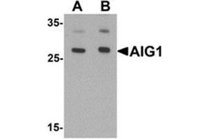 Western blot analysis of AIG1 in human brain tissue lysate with AIG1 antibody at (A) 1 and (B) 2 ug/mL. (AIG1 Antikörper  (N-Term))