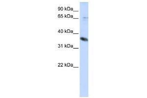 ST6GALNAC1 antibody used at 1 ug/ml to detect target protein. (ST6GALNAC1 Antikörper)
