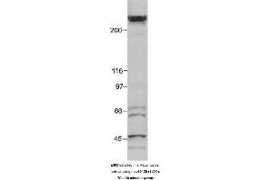 Image no. 1 for anti-E1A Binding Protein P300 (EP300) (AA 1572-2371) antibody (ABIN363280) (p300 Antikörper  (AA 1572-2371))