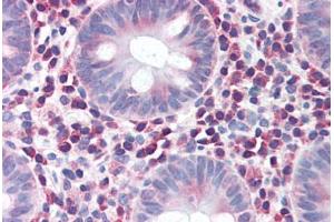 Human Colon (formalin-fixed, paraffin-embedded) stained with IRGM antibody ABIN351455 at 5 ug/ml followed by biotinylated goat anti-rabbit IgG secondary antibody ABIN481713, alkaline phosphatase-streptavidin and chromogen. (IRGM Antikörper  (Internal Region))