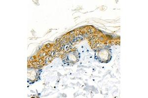 Immunohistochemistry (Paraffin-embedded Sections) (IHC (p)) image for anti-Keratin 13 (KRT13) (C-Term) antibody (ABIN7074411)