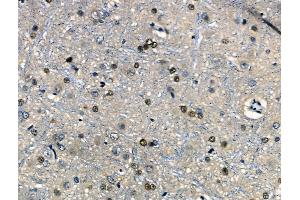 ABIN6262248 and ABIN6266737 at 1/100 staining Rat brain tissue by IHC-P. (Histone H1 Antikörper  (Internal Region))