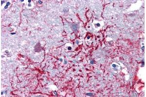 Human Brain, Cortex (formalin-fixed, paraffin-embedded) stained with DHX58 antibody ABIN351452 at 5 ug/ml followed by biotinylated goat anti-rabbit IgG secondary antibody ABIN481713, alkaline phosphatase-streptavidin and chromogen. (DHX58 Antikörper  (Internal Region))