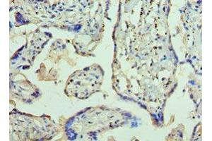 Immunohistochemistry (IHC) image for anti-Adaptor-Related Protein Complex 2, beta 1 Subunit (AP2B1) (AA 738-937) antibody (ABIN7144363)
