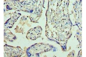 Immunohistochemistry of paraffin-embedded human placenta tissue using ABIN7144363 at dilution of 1:100 (AP2B1 Antikörper  (AA 738-937))