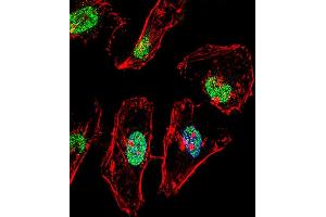Fluorescent confocal image of Hela cell stained with TBX6 Antibody (Center) (ABIN656001 and ABIN2845380). (T-Box 6 Antikörper  (AA 264-293))