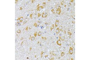 Immunohistochemistry (IHC) image for anti-Eukaryotic Translation Initiation Factor 2B, Subunit 2 Beta, 39kDa (EIF2B2) (AA 1-351) antibody (ABIN6140037)