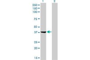 Western Blot analysis of EIF2B2 expression in transfected 293T cell line by EIF2B2 monoclonal antibody (M01), clone 5B12-E10. (EIF2B2 Antikörper  (AA 1-351))