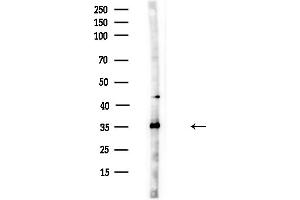 anti-Lactate Dehydrogenase B (LDHB) (N-Term) antibody