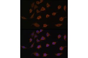 Immunofluorescence analysis of L929 cells using LSM1 antibody (ABIN6131868, ABIN6143353, ABIN6143354 and ABIN6216476) at dilution of 1:100. (LSM1 Antikörper  (AA 1-133))