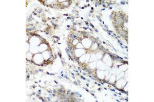 Immunohistochemistry of paraffin-embedded human colon using NAA60 antibody at dilution of 1:200 (40x lens). (NAT15 Antikörper)