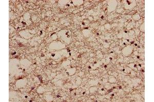 Immunohistochemistry (IHC) image for anti-NQO2 (NQO2) (AA 1-231) antibody (ABIN7168220)