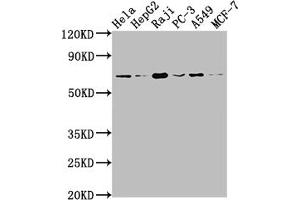 Western Blot Positive WB detected in: Hela whole cell lysate, HepG2 whole cell lysate, Raji whole cell lysate, PC-3 whole cell lysate, A549 whole cell lysate, MCF-7 whole cell lysate All lanes: ALAS1 antibody at 1:1500 Secondary Goat polyclonal to rabbit IgG at 1/50000 dilution Predicted band size: 71, 13 kDa Observed band size: 71 kDa (Rekombinanter ALAS1 Antikörper)