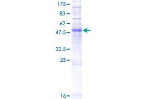 Image no. 1 for Olfactory Receptor, Family 4, Subfamily C, Member 15 (OR4C15) (AA 1-316) protein (GST tag) (ABIN1313527) (OR4C15 Protein (AA 1-316) (GST tag))