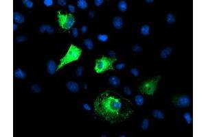 Anti-FBXO21 mouse monoclonal antibody (ABIN2455367) immunofluorescent staining of COS7 cells transiently transfected by pCMV6-ENTRY FBXO21 (RC223095). (FBXO21 Antikörper)
