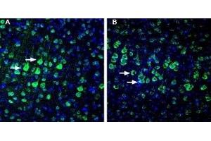 Expression of NETO1 in rat and mouse cortex. (NETO1 Antikörper  (Extracellular))