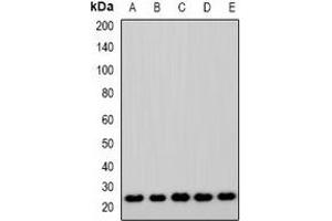 Western blot analysis of ASF1A expression in Jurkat (A), A549 (B), MCF7 (C), mouse lung (D), rat lung (E) whole cell lysates. (ASF1A Antikörper)