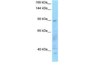 WB Suggested Anti-SECISBP2 Antibody Titration: 1.