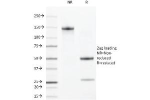 SDS-PAGE Analysis Purified VEGFR2 Rat Monoclonal Antibody (DC101). (VEGFR2/CD309 Antikörper)
