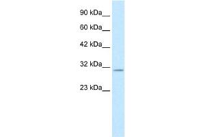 WB Suggested Anti-KCNIP4 Antibody Titration:  0. (KCNIP4 Antikörper  (N-Term))