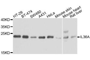 Western blot analysis of extracts of various cell lines, using IL36A antibody. (IL36A/IL1F6 Antikörper  (AA 1-158))