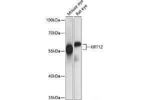 Western blot analysis of extracts of various cell lines using KRT12 Polyclonal Antibody at dilution of 1:1000. (KRT12 Antikörper)