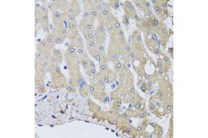 Immunohistochemistry of paraffin-embedded human liver injury using NSF antibody at dilution of 1:100 (x40 lens).