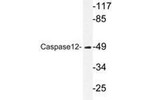 Western blot analysis of Caspase12 antibody in extracts from HUVEC cells.