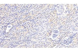Detection of GSTM2 in Human Kidney Tissue using Polyclonal Antibody to Glutathione S Transferase Mu 2 (GSTM2) (GSTM2 Antikörper  (AA 3-218))