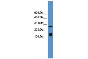 Western Blot showing Il5 antibody used at a concentration of 1-2 ug/ml to detect its target protein.