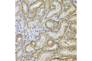 Immunohistochemistry (Paraffin-embedded Sections) (IHC (p)) image for anti-Cadherin-16 (CDH16) (AA 19-230) antibody (ABIN6138291)