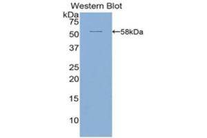 Western Blotting (WB) image for anti-Activated Leukocyte Cell Adhesion Molecule (ALCAM) (AA 28-527) antibody (ABIN3201204) (CD166 Antikörper  (AA 28-527))
