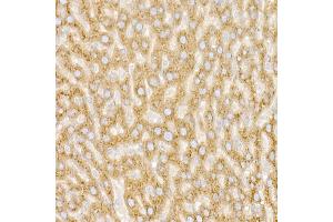 Immunohistochemistry (IHC) image for anti-Golgin A2 (GOLGA2) (AA 20-300) antibody (ABIN6141264)