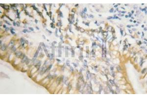 Phospho-c-Met (Tyr1003) Antibody for IHC in human testis