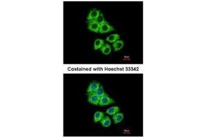 ICC/IF Image Immunofluorescence analysis of methanol-fixed Hep G2, using Coronin 1A, antibody at 1:500 dilution. (Coronin 1a Antikörper  (C-Term))
