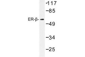 Image no. 1 for anti-Estrogen Receptor 2 (ESR2) antibody (ABIN272305) (ESR2 Antikörper)