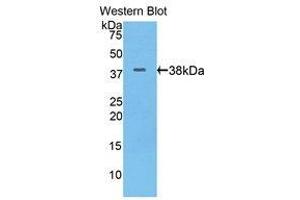Western Blotting (WB) image for anti-Keratin 17 (KRT17) (AA 84-392) antibody (ABIN1175075) (KRT17 Antikörper  (AA 84-392))