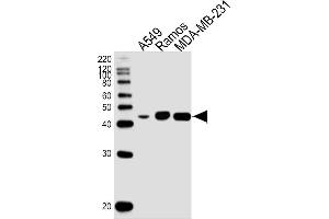 Lane 1: A549 Cell lysates, Lane 2: Ramos Cell lysates, Lane 3: MDA-MB-231 Cell lysates, probed with HLA-G (800CT6. (HLAG Antikörper)