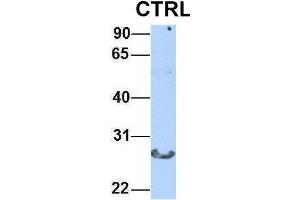 Host:  Rabbit  Target Name:  CTRL  Sample Type:  Human Adult Placenta  Antibody Dilution:  1.