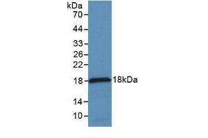 Detection of Recombinant MCP1, Rabbit using Monoclonal Antibody to Monocyte Chemotactic Protein 1 (MCP1) (CCL2 Antikörper  (AA 24-125))