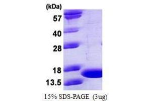 Figure annotation denotes ug of protein loaded and % gel used. (TNF alpha Protein)