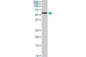 HDAC1 monoclonal antibody (M02), clone 3E1. (HDAC1 Antikörper  (AA 1-482))
