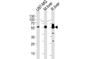 Western Blotting (WB) image for anti-3-Hydroxy-3-Methylglutaryl-CoA Synthase 1 (Soluble) (HMGCS1) antibody (ABIN3002732) (HMGCS1 Antikörper)