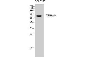 Western Blotting (WB) image for anti-General Transcription Factor IIH, Polypeptide 2, 44kDa (GTF2H2) (N-Term) antibody (ABIN3187237) (GTF2H2 Antikörper  (N-Term))